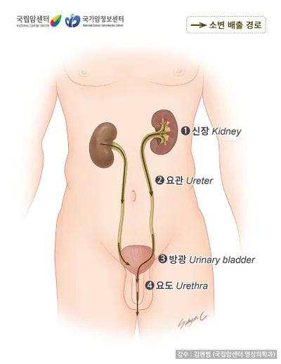 신장암·방광암 1기부터 4기까지, 가족이 병기 설명을 들을 때 놓치기 쉬운 말